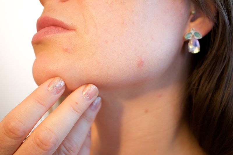 Visita dermatologica, a cosa serve e quanto costa